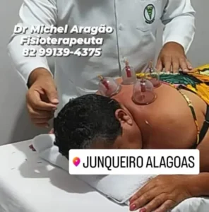 Paciente em sessão de ventosaterapia realizada pelo Dr. Michel Aragão no consultório em Junqueiro – AL.